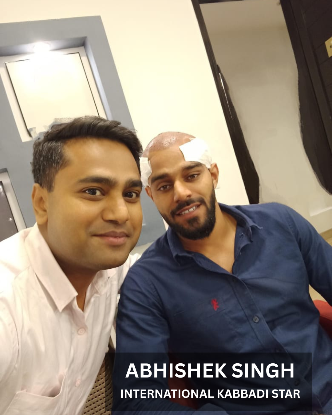 Hair restoration before after